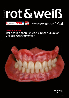 Titelseite der Zeitschrift "rot & weiß" mit dem Hauptthema "Der richtige Zahn für jede klinische Situation und alle Gesichtsformen" und einem Bild eines Zahnmodells, Ausgabe 1/24.