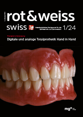 Titelseite der Zeitschrift "rot & weiss swiss" mit dem Hauptthema "Digitale und analoge Totalprothetik Hand in Hand" und einem Bild eines Zahnmodells, Ausgabe 1/24.